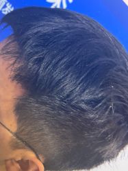 点击看大图 -雍禾植发全国连锁