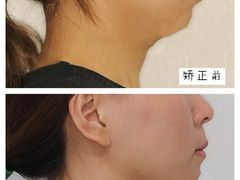 -团圆口腔·种植中心(锦江院区)