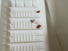 -上海仁爱医院口腔科 · 种植