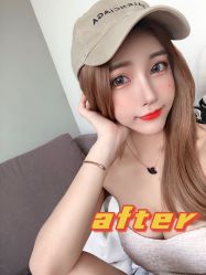 -广州美莱医疗美容医院