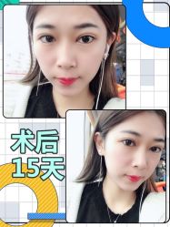 -广东韩妃整形外科医院