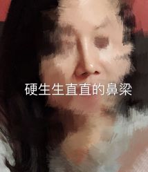 体验后-深圳鹏爱悦心医疗美容医院