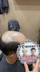 -唐风采假发补发定制