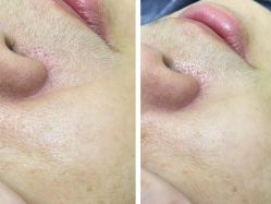 -杉惠素颜美妆皮肤管理中心