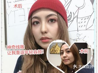 神奇线雕重返年轻容颜️️