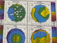 -美尔目眼科医院·近视手术·儿童近视(通州店)
