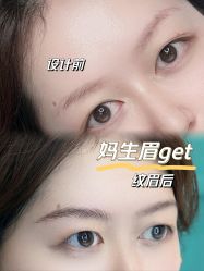 -杨益美学·野生眉半永久纹眉发际线