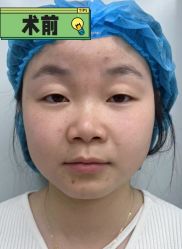 -素美医疗美容·西南眼鼻整形·修复基地