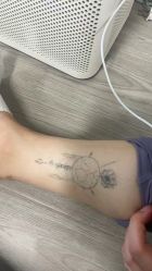 -天道专业洗纹身