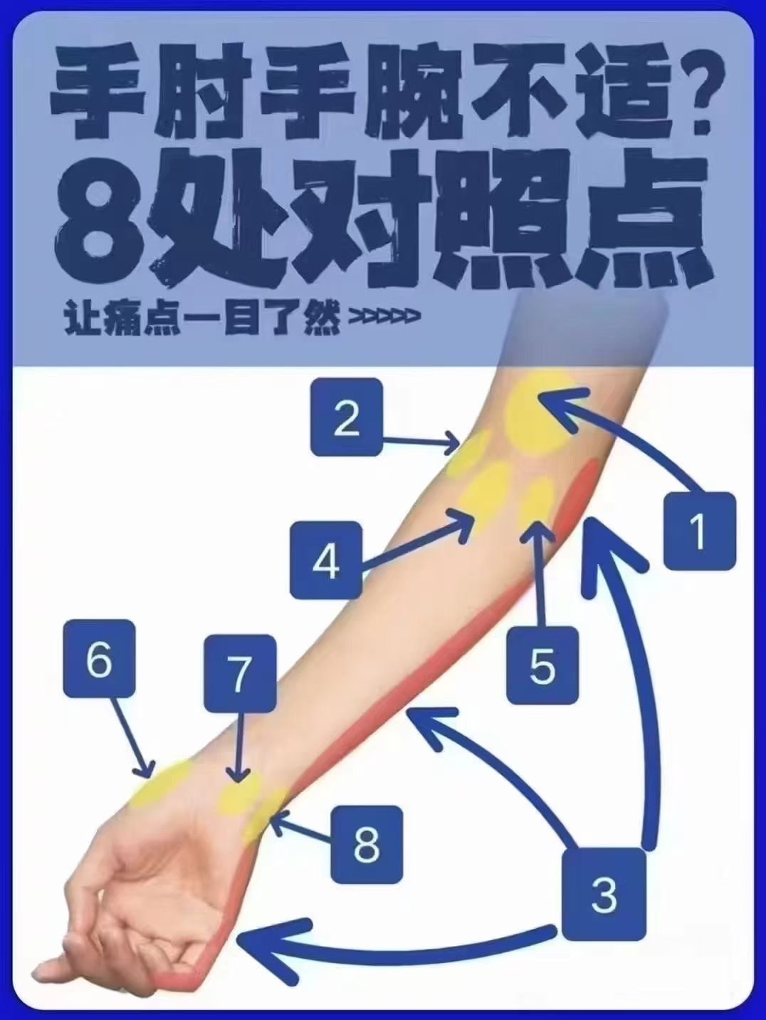 1. 旋前圆肌综合征:主要影响前臂肌肉