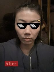 体验后-上海伊莱美医疗美容医院