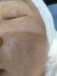 体验后-四川米兰柏羽医学美容医院