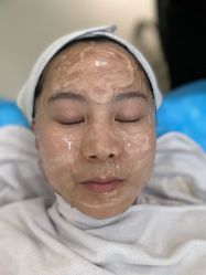 体验前-联合丽格·张菡丽格医疗美容