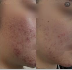 -SOS修丽可.痘肌修复中心