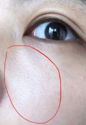 -东莞缔美美容医院