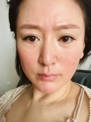 体验后-北京丽星翼美医疗美容