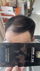 -发饰美男士增发补发假发定制店