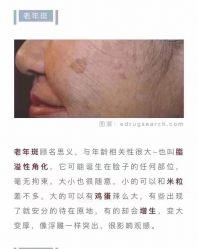 -倩极·精研痘敏肌管理