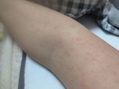 -复旦大学附属华山医院(总院)