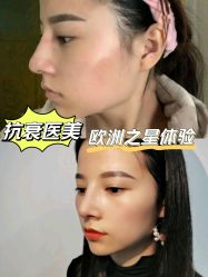 -天津时光诺颜·轻医美·轮廓抗衰中心