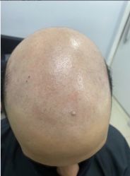 -发饰美男士增发补发假发定制店