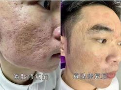 -蕾特恩专业祛痘·皮肤管理
