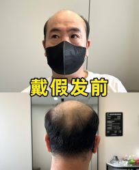 -唐风采假发补发定制