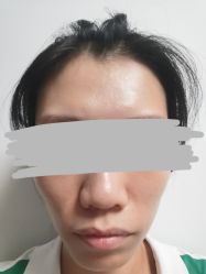 体验前-美莱医疗美容医院