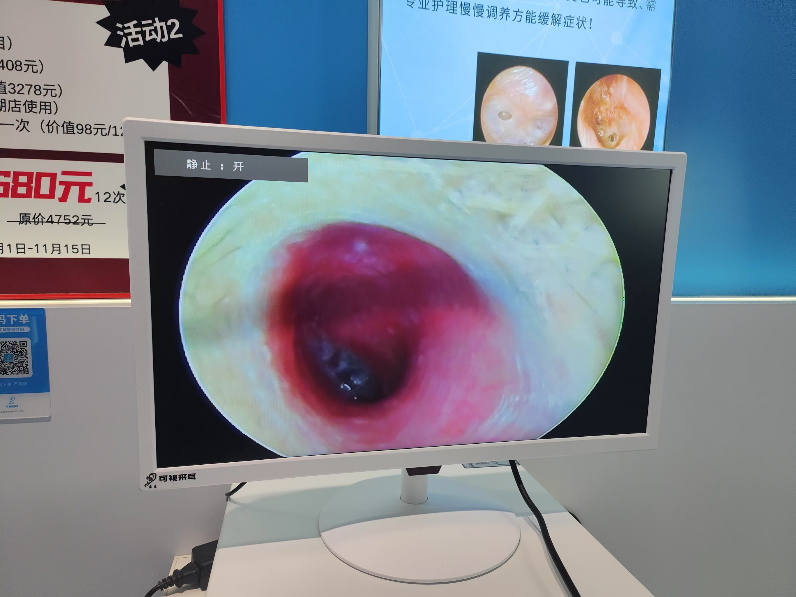 耳朵长霉菌,心路历程