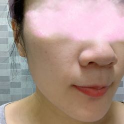 体验后-Metime美天医疗美容