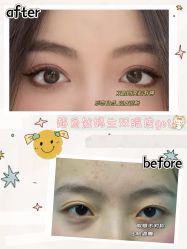 -素美医疗美容·西南眼鼻整形·修复基地