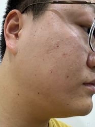 -成都西区医院整形美容