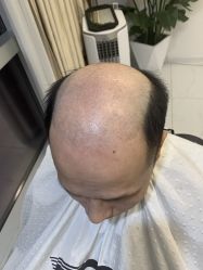 -发饰美男士增发补发假发定制店