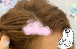 -大麦微针植发全国连锁