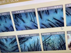 -丝客富脱发养发头皮馆