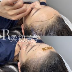 -RC半永久纹眉纹发际线