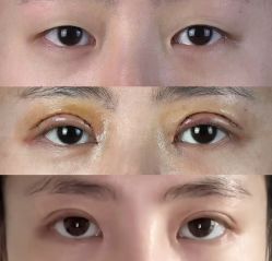 -Yestar重庆艺星医疗美容医院