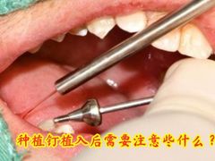 -团圆口腔·种植中心(锦江院区)