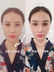 -SEAS小顏·日本小颜整骨美容サロン