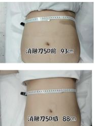 -Lily纤美·科技减脂中心