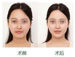 -CMS西美斯·美式医疗美容