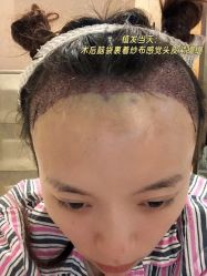 -雍禾植发全国连锁