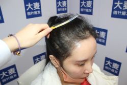 -大麦微针植发丨全国连锁