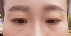 -新美荟医美·专注面部美学抗衰