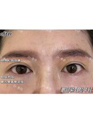 -杭州米兰柏羽医疗美容医院