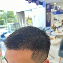 -大麦微针植发全国连锁