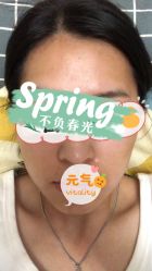 体验前-JUVA郑州欧华医疗美容医院