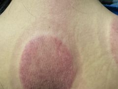 -理疗君·古法推拿姜疗SPA馆(东门店)