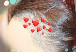 -大麦微针植发全国连锁