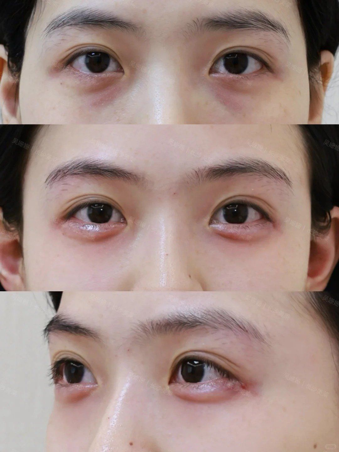 biu到了!为颜值上大分的卧蚕!